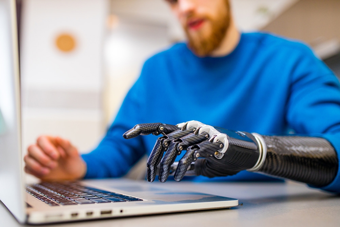 Mann bedient einen Laptop mit Hilfe einer Armprothese